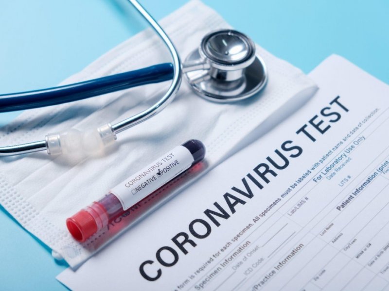 Dünyada koronavirus infeksiyasına yoluxanların sayı 16,2 milyonu ötüb